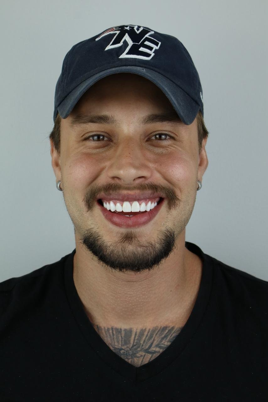 Paciente sorrindo após tratamento com lentes em resina